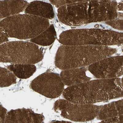 Immunohistochemistry-Paraffin: Flightless I Antibody [NBP1-87926]