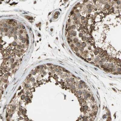 Immunohistochemistry-Paraffin: Flightless I Antibody [NBP1-87926]
