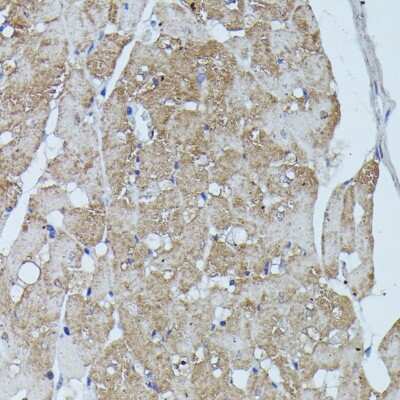 Immunohistochemistry-Paraffin: Flightless I Antibody - Azide and BSA Free [NBP3-03712]