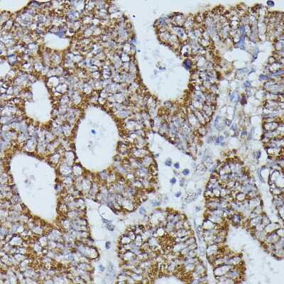 Immunohistochemistry-Paraffin: Flightless I Antibody - Azide and BSA Free [NBP3-03712]