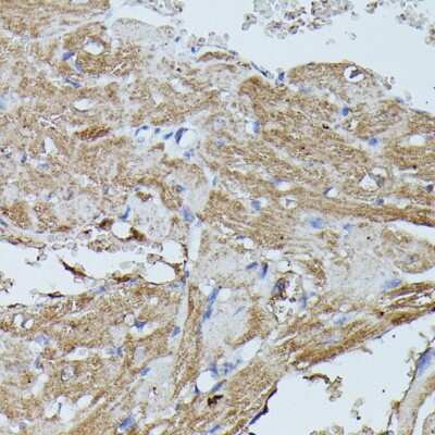 Immunohistochemistry-Paraffin: Flightless I Antibody - Azide and BSA Free [NBP3-03712]