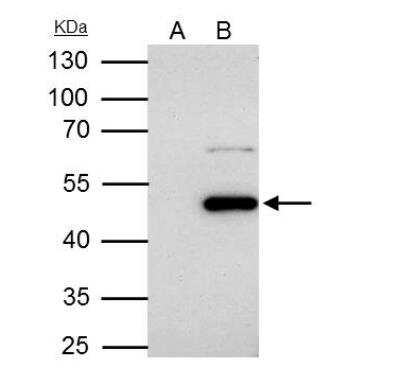 Immunoprecipitation: Flotillin-1 Antibody [NBP2-16508]