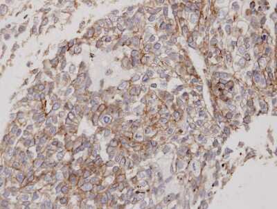 Immunohistochemistry-Paraffin: Flotillin 2 Antibody [NBP1-30881]