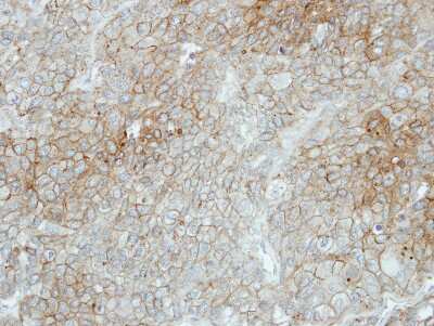 Immunohistochemistry-Paraffin: Flotillin 2 Antibody [NBP2-16507]