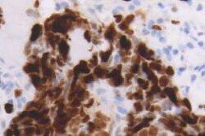 Immunohistochemistry-Paraffin: Flt-3/Flk-2/CD135 Antibody (12B6) - Azide and BSA Free [NB110-94155]