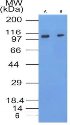 Western Blot: Flt-3/Flk-2/CD135 Antibody (7E8.2C8)Azide and BSA Free [NBP2-80739]