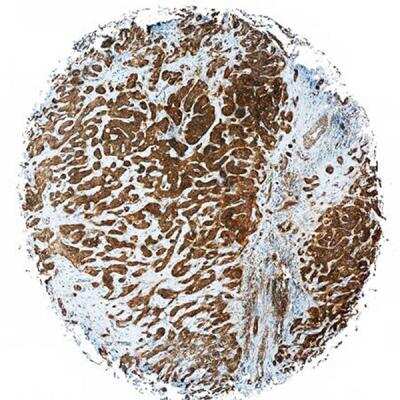 Immunohistochemistry-Paraffin: Flt-3/Flk-2/CD135 Antibody (7E8.2C8) - BSA Free [NBP2-42210]