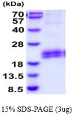 SDS-PAGE: Recombinant Mouse Flt-3 Ligand/FLT3L His Protein [NBP2-52182]