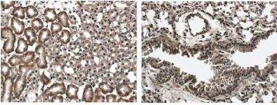 Immunohistochemistry: Flt-3/Flk-2/CD135 Antibody (12B6) - Azide and BSA Free [NB110-94155]