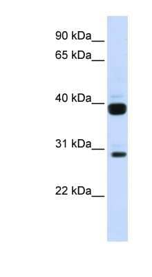 Western Blot: Flt-3 Ligand/FLT3L Antibody [NBP1-62304]