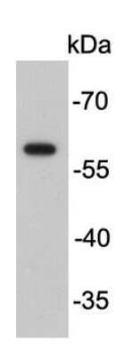Western Blot: Fok1 Antibody [NBP2-66850]