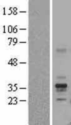 Western Blot: FOLR1 Overexpression Lysate [NBL1-10790]