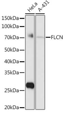 Western Blot: Folliculin AntibodyAzide and BSA Free [NBP3-03461]