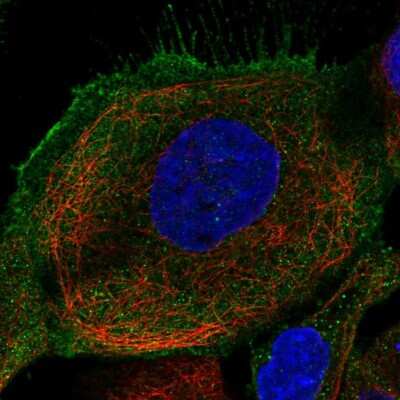 Immunocytochemistry/ Immunofluorescence: Folliculin Antibody [NBP1-89983]