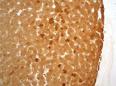 Immunohistochemistry-Paraffin: Folliculin Antibody [NBP1-44995]