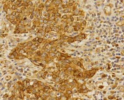 Immunohistochemistry-Paraffin: Folliculin Antibody [NBP1-44995]