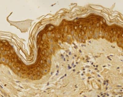 Immunohistochemistry-Paraffin: Folliculin Antibody [NBP1-44995]