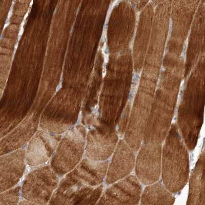 Immunohistochemistry-Paraffin: Folliculin Antibody [NBP1-89983]