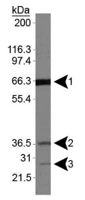 Western Blot: Folliculin Antibody [NBP1-44995]