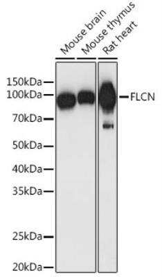 Western Blot: Folliculin AntibodyAzide and BSA Free [NBP3-03257]