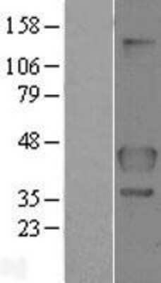 Western Blot: Folliculin Overexpression Lysate [NBL1-10747]