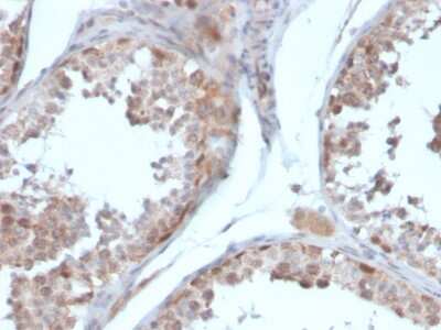 Immunohistochemistry-Paraffin: Follistatin Antibody (FST/4281) - Azide and BSA Free [NBP3-08813]