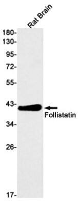 Western Blot: Follistatin Antibody (S08-8F4) [NBP3-19636]