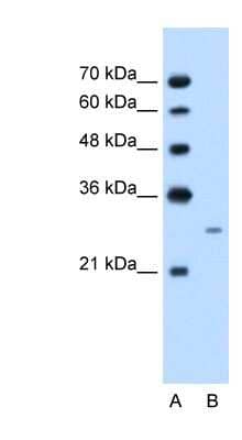 Western Blot: Follistatin Antibody [NBP1-57996]