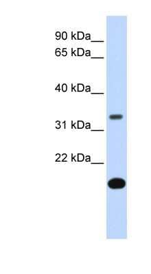 Western Blot: Follistatin Antibody [NBP1-57997]