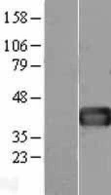 Western Blot: Follistatin Overexpression Lysate [NBL1-10846]