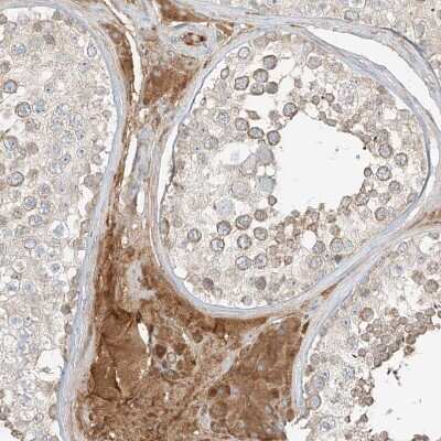 Immunohistochemistry-Paraffin: Follistatin-like 1/FSTL1 Antibody [NBP1-83425]