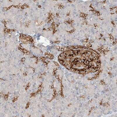 Immunohistochemistry-Paraffin: Follistatin-like 1/FSTL1 Antibody [NBP1-83425]