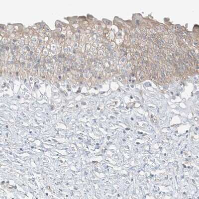 Immunohistochemistry-Paraffin: Follistatin-like 1/FSTL1 Antibody [NBP1-83425]