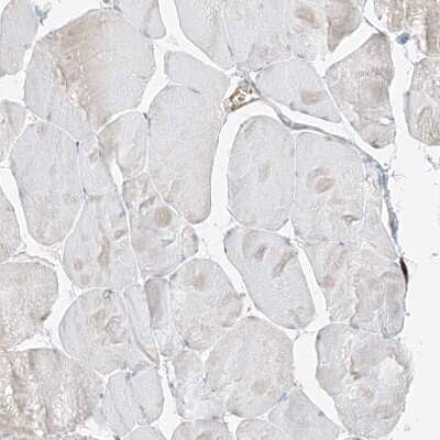 Immunohistochemistry-Paraffin: Follistatin-like 1/FSTL1 Antibody [NBP1-83425]