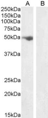 Western Blot: Follistatin-like 1/FSTL1 Antibody [NB100-1095]