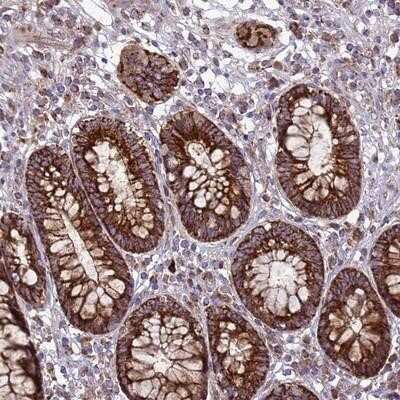 Immunohistochemistry-Paraffin: Follistatin-like 4/FSTL4 Antibody [NBP1-91913]