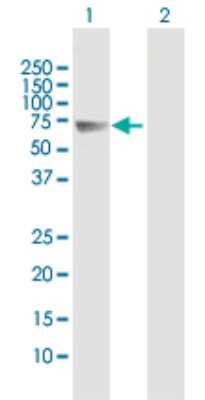 Western Blot: Follistatin-like 4/FSTL4 Antibody [H00023105-B01P]