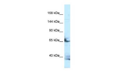 Western Blot: Follistatin-like 4/FSTL4 Antibody [NBP3-09413]