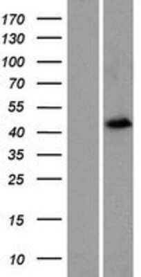 Western Blot: Forkhead box D4-like 4 Overexpression Lysate [NBP2-04557]