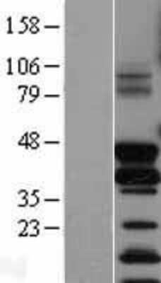 Western Blot: FosB/G0S3 Overexpression Lysate [NBL1-10795]