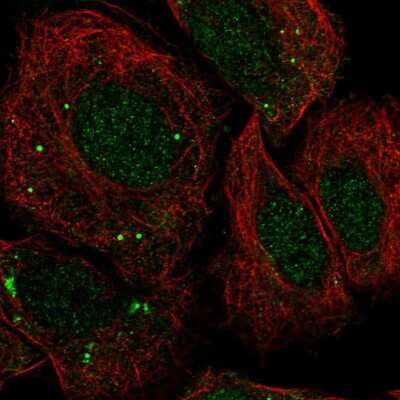 Immunocytochemistry/ Immunofluorescence: FosB/G0S3 Antibody [NBP2-56210]