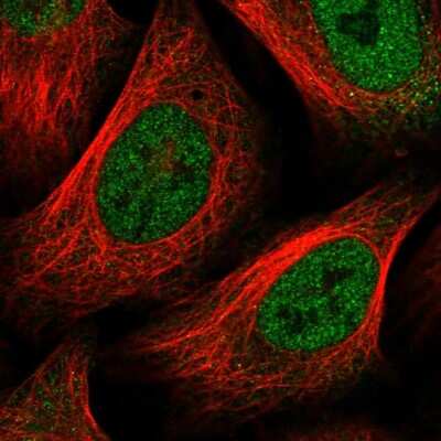 Immunocytochemistry/ Immunofluorescence: FoxC1 Antibody [NBP1-89025]
