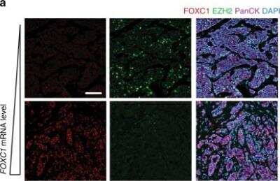 Immunohistochemistry: FoxC1 Antibody [NB100-1268]