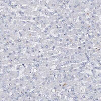 Immunohistochemistry-Paraffin: FoxC1 Antibody [NBP1-89025]