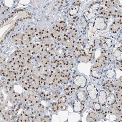 Immunohistochemistry-Paraffin: FoxC1 Antibody [NBP1-89025]