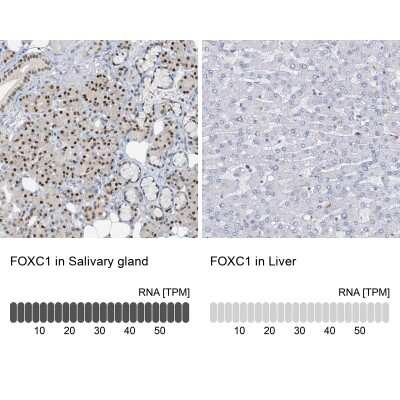 Immunohistochemistry-Paraffin: FoxC1 Antibody [NBP1-89025]