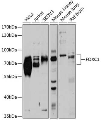 Western Blot: FoxC1 AntibodyBSA Free [NBP3-05017]