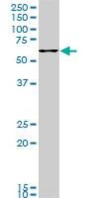Western Blot: FoxC2 Antibody (1A8) [H00002303-M04]