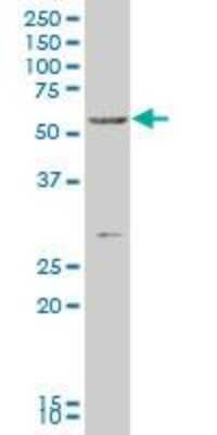Western Blot: FoxC2 Antibody (1A8) [H00002303-M04]