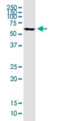 Western Blot: FoxC2 Antibody (1A8) [H00002303-M04]